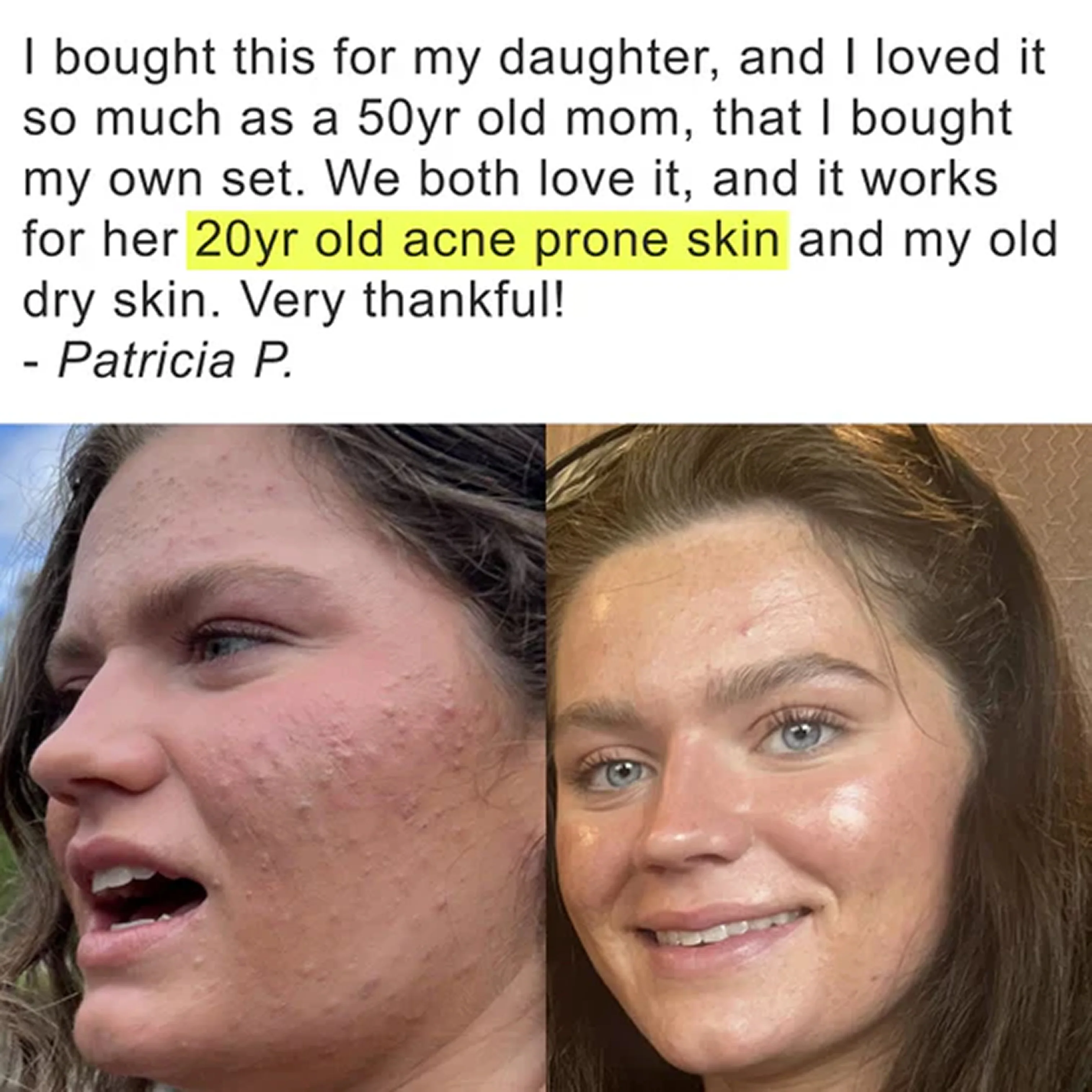 Pimple Scars Balm 2.0 - Image 16