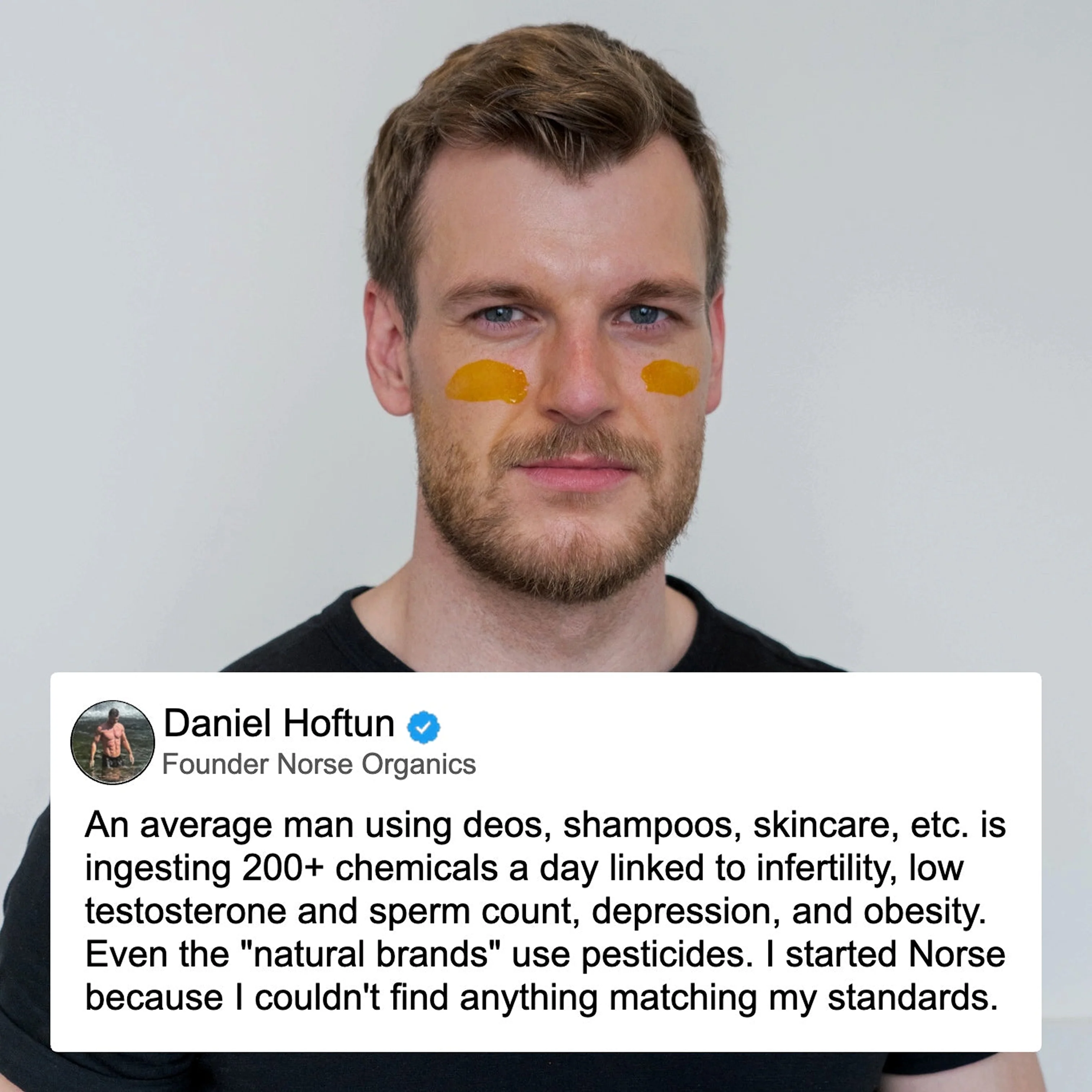 Pimple Scars Balm 2.0 - Image 9