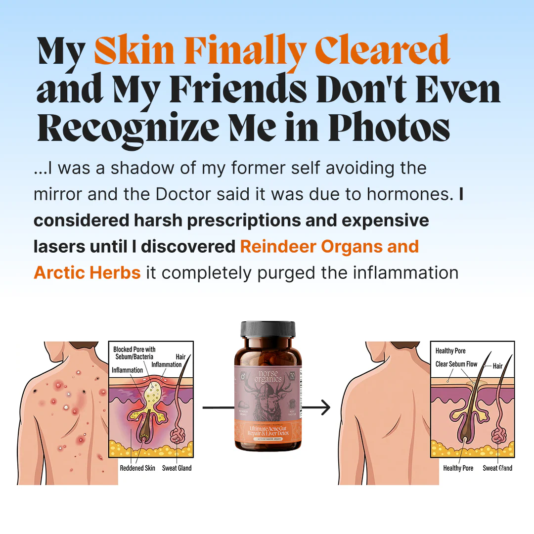 Complete Gut Repair & Hormonal Balance System for Female Acne - Image 15