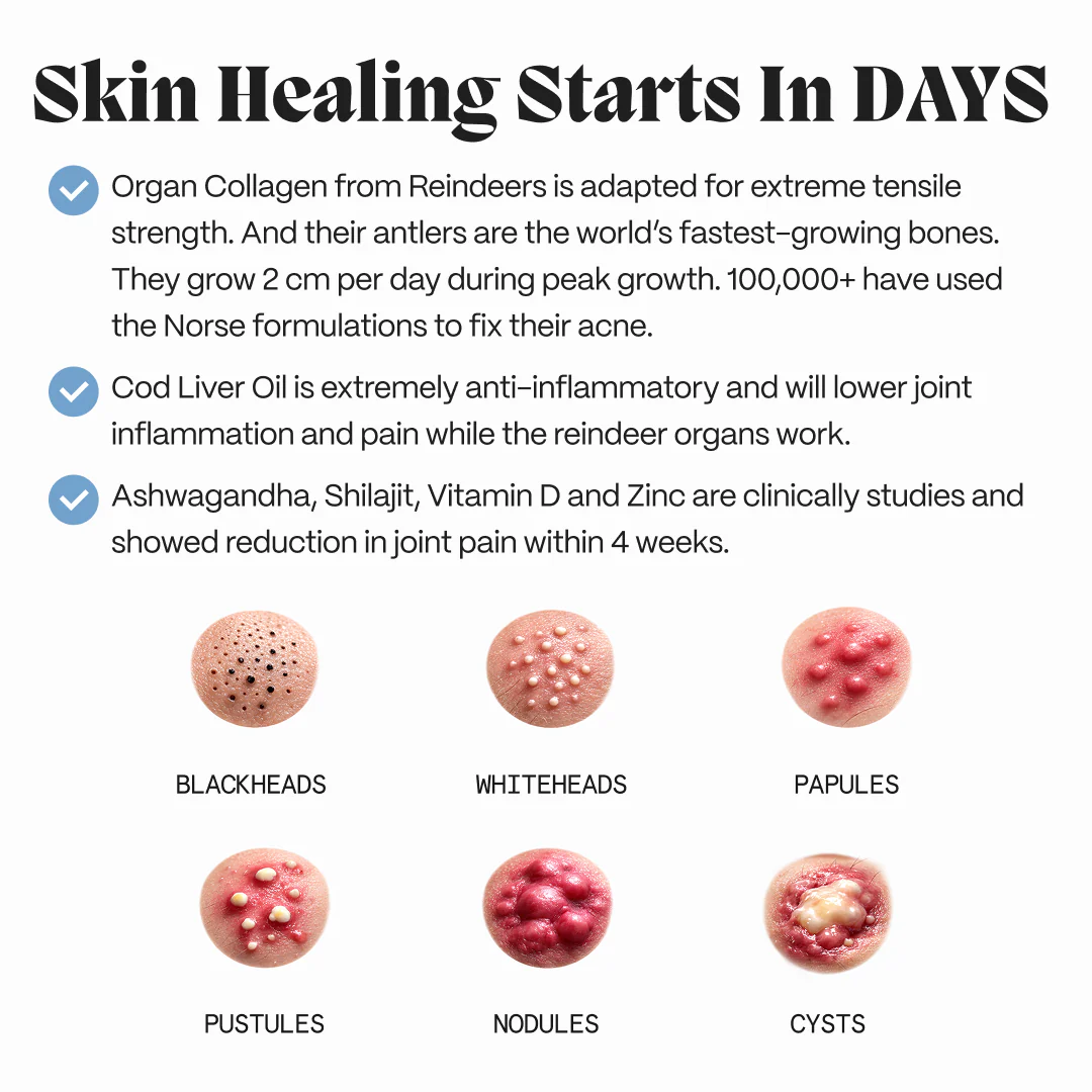 Complete Gut Repair & Hormonal Balance System for Female Acne - Image 19