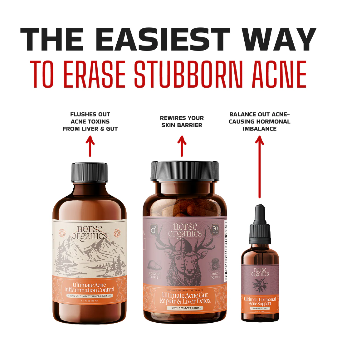 Complete Gut Repair & Hormonal Balance System for Female Acne - Image 8