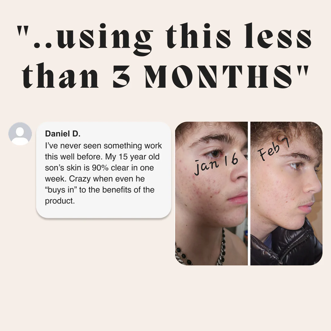 Complete Gut Repair & Hormonal Balance System for Male Acne - Image 16
