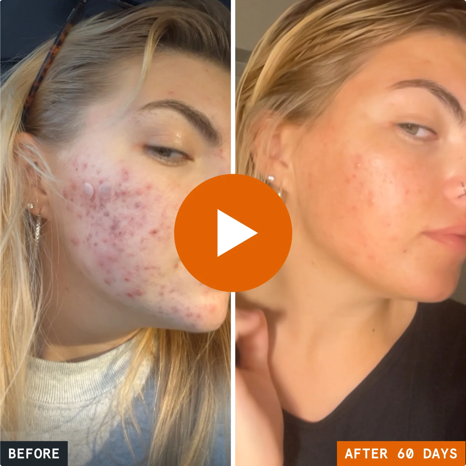 Kill Acne & Redness Ritual - Image 12