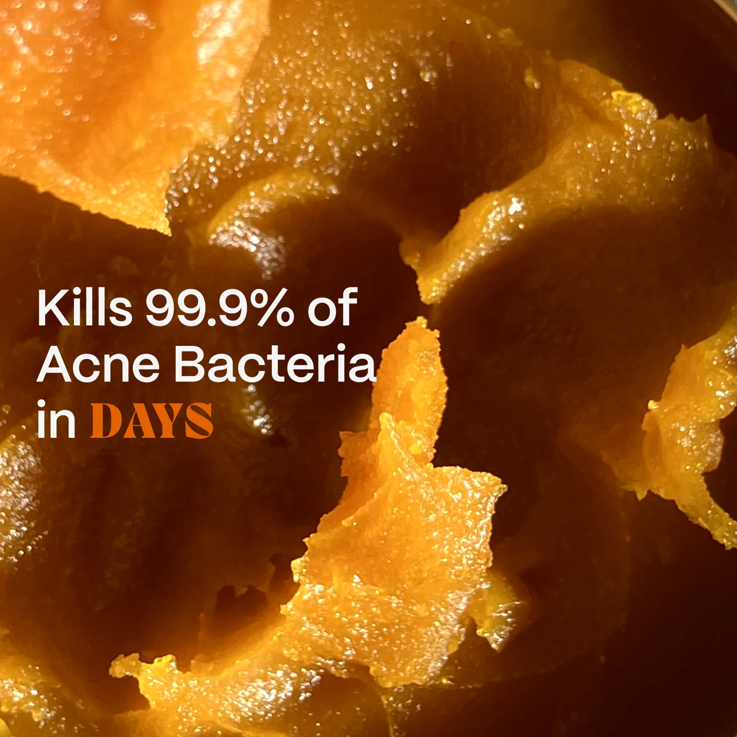 The Complete Acne Killer System 2.0 - Image 12