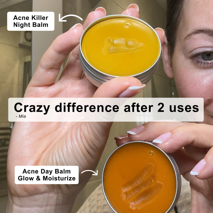 The Complete Acne Killer System 2.0 - Image 8